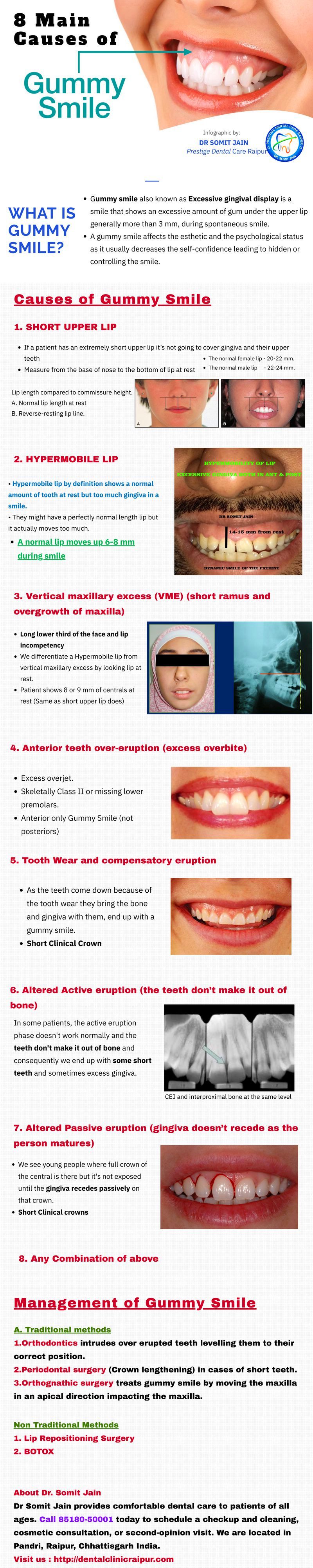 DENTAL INFOGRAPHICS SHOWING MAIN CAUSES OF GUMMY SMILE OR EXCESSIVE GINGIVAL DISPLAY