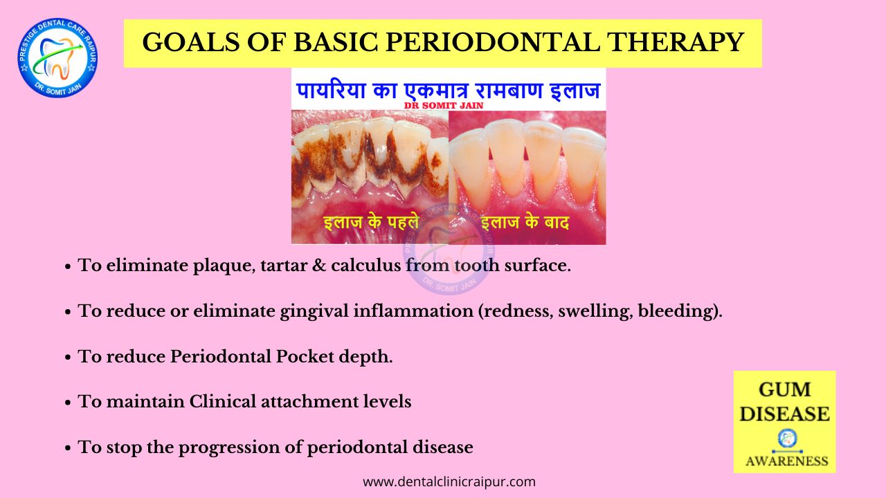 GOALS OF BASIC PERIODONTAL THERAPY