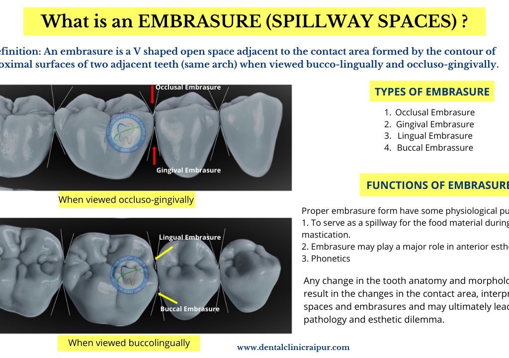 EMBRASURE SPILLWAY SPACES
