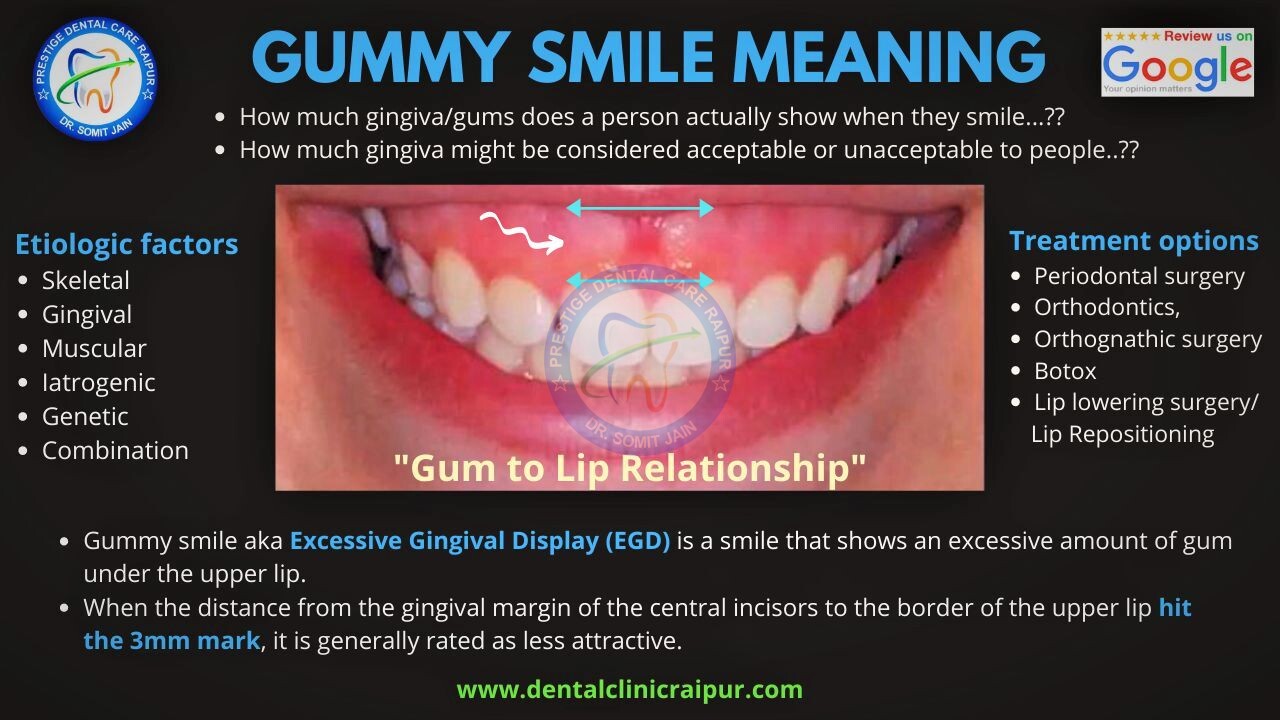 GUMMY SMILE MEANING
