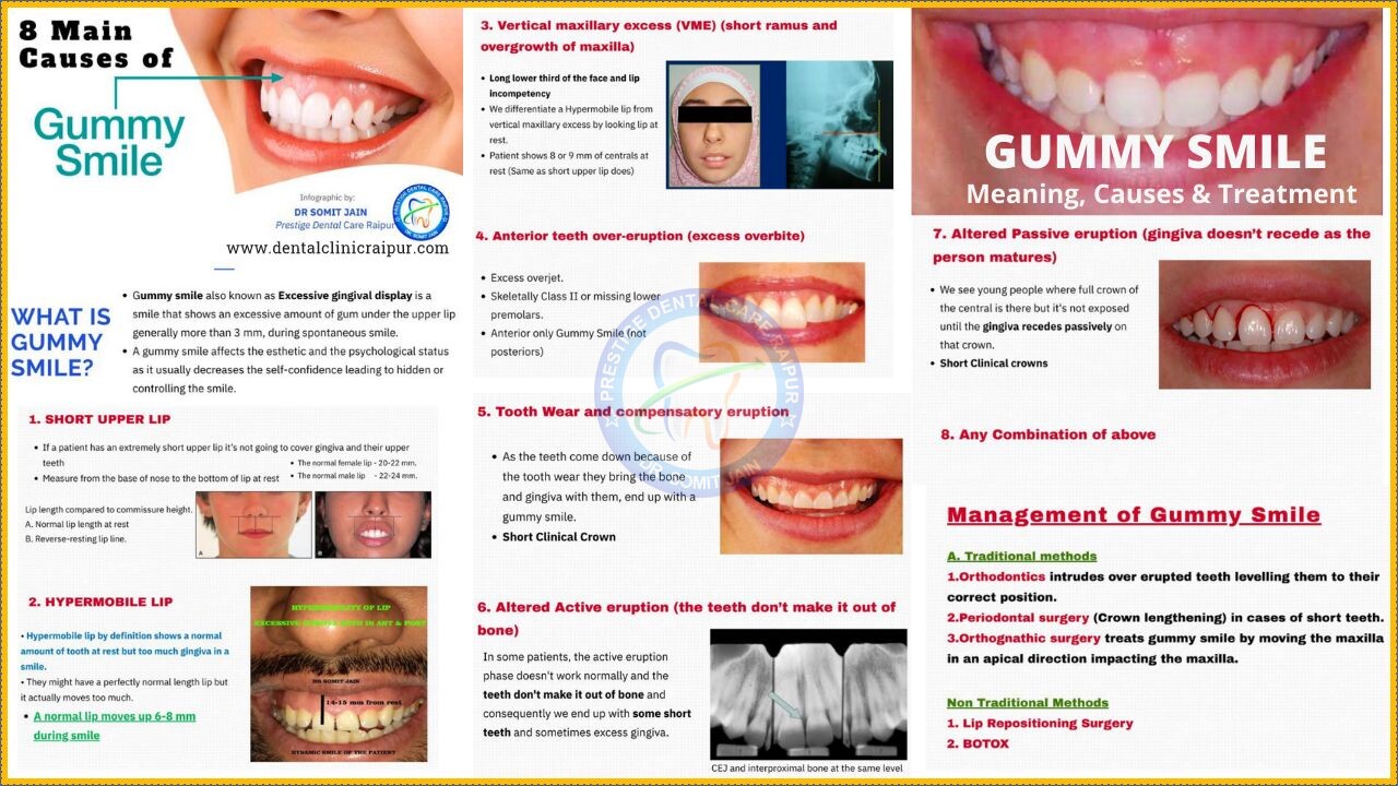 GUMMY SMILE- Meaning, causes & treatment