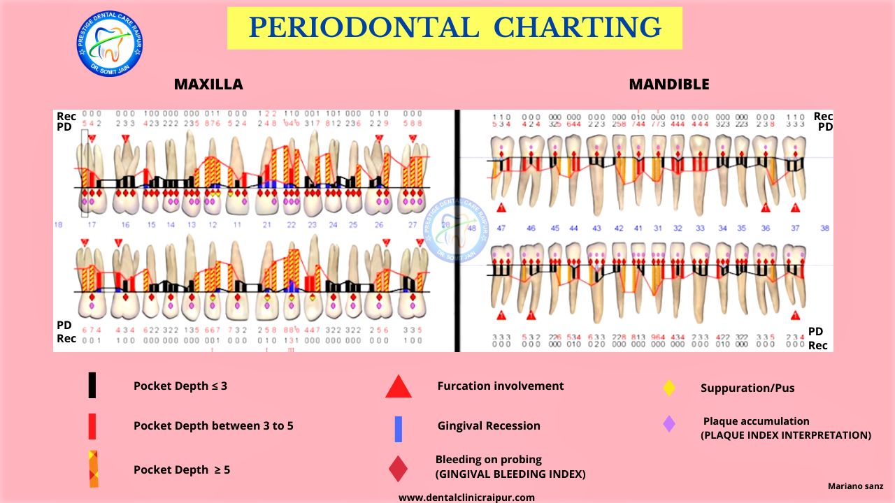 PERIODONTAL CHARTING