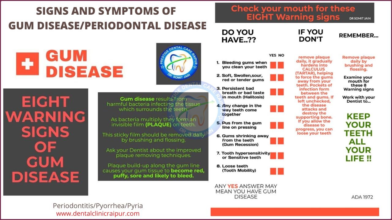 SYMPTOMS OF GUM DISEASE OR PERIODONTITIS