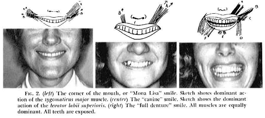 3 TYPES OF SMILE
